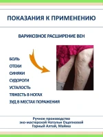 Крем от варикоза с конским каштаном и живицей кедра — фото 4