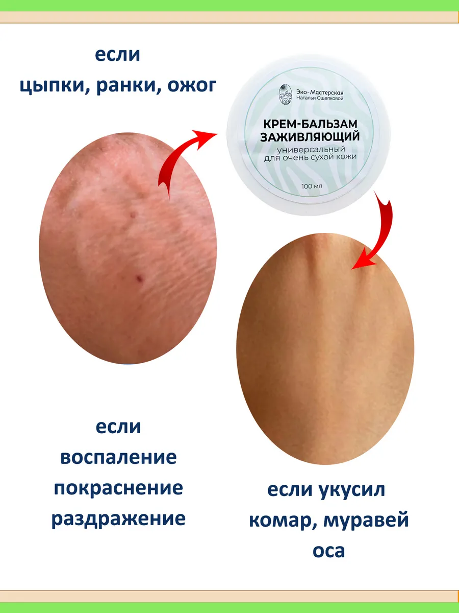 Заживляющий крем бальзам для тела с мумие и живицей