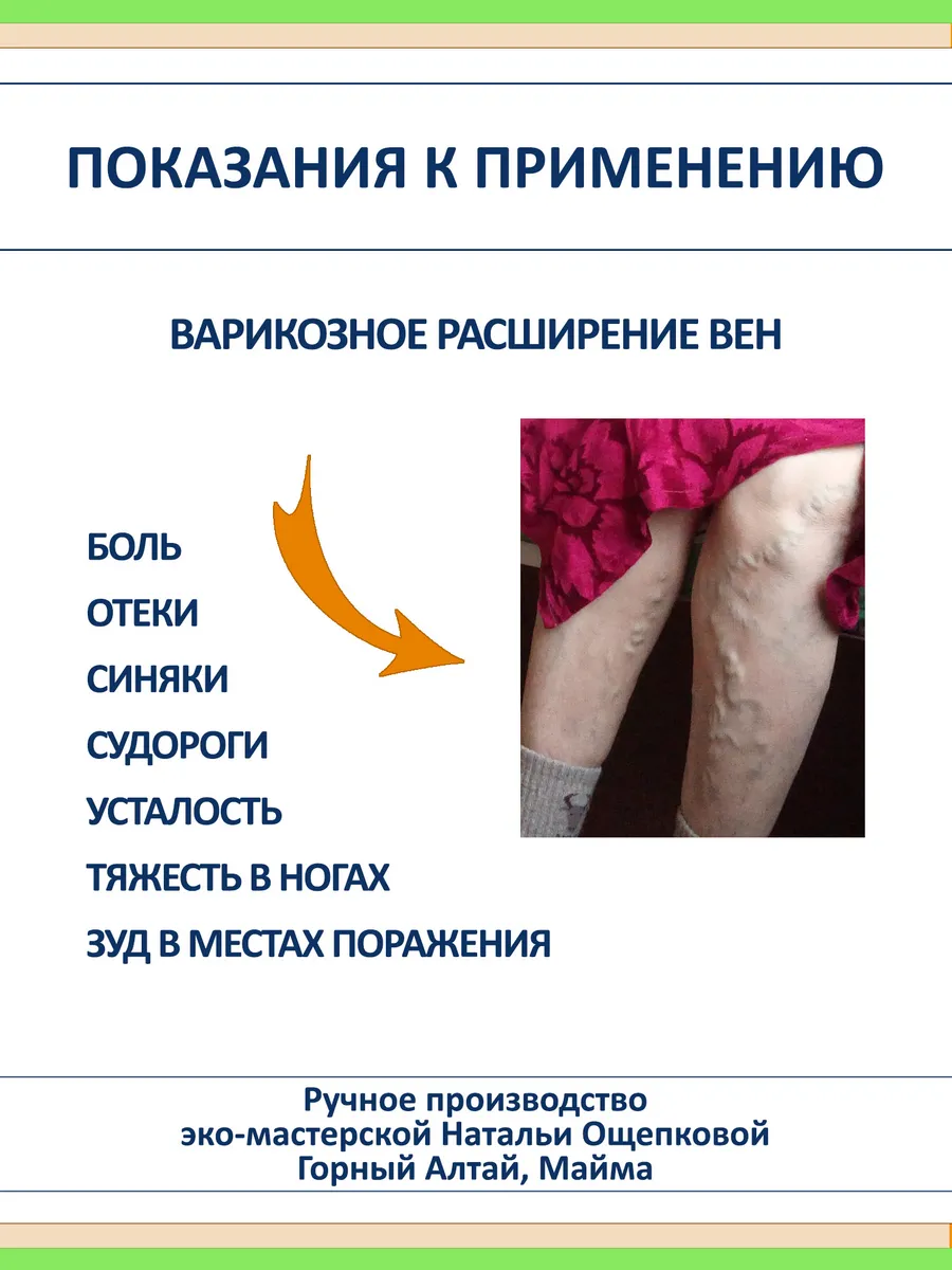 Крем от варикоза с конским каштаном и живицей кедра